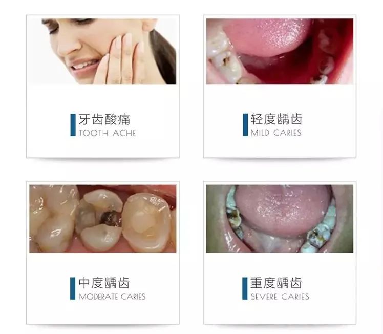 【八店通用&京立口腔】您身边的口腔专家~仅49.9元抢门市价680元一大一小口腔护理套餐!口腔检查+ 曲面断层片+成人超声波洁牙+无痕抛光 儿童防龋涂氟+儿童正畸设计方案……让孩子和你都拥有一口健康白净的牙齿~