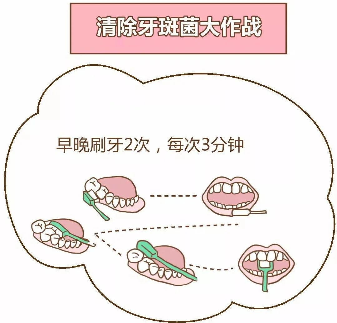 超声波洗牙 进口树脂补牙(仅限后磨牙 儿童全口涂氟 儿童窝沟